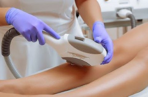 3 alkalmas végleges SHR OPT szőrtelenítő bérlet