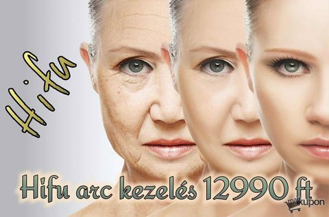 HIFU ultrahangos bőrfiatalítás arcra