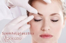 Felső szemhéjplasztika mindkét szemhéjon konzultációval a fiatalos tekintetért