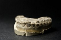 Éjszakai harapásemelő sín felső fogívre fogcsikorgatóknak