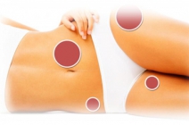 3 alkalmas kavitációs zsírbontás rádiófrekvenciával és hullámmasszázzsal választható területen + alkalmanként 45 perces testmasszázs és arcpakolás 88.000 Ft helyett 13.990 Ft-ért a Linus Alakformálás szalonban