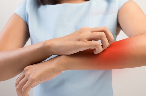 Krónikus bőrgyulladások, ekcéma vizsgálata