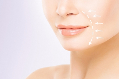 UltraLift HIFU mosolyránc feltöltés