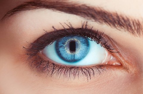 OptiLASIK lézeres látásjavítás mindkét szemre