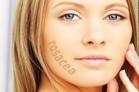 Rosacea eltüntetés teljes arcon