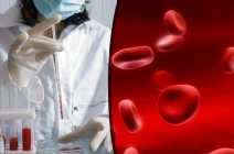 Tegyél szíved és szervezeted egészségéért! Komplex vérvitalitás-mérés digitális és száraz vér analízissel + 2 alkalom Bioquant lézerterápia kezelés