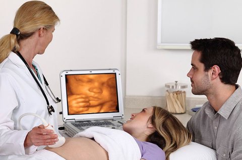4D baba ultrahang vizsgálat DVD-re és CD-re rögzítve