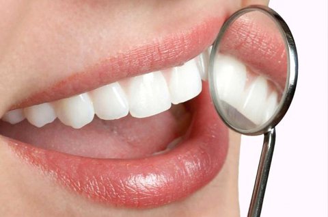 Ragyogó fogak ultrahangos fogkő-eltávolítással