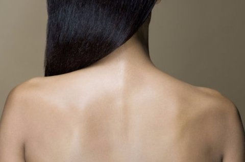 IPL E-Light akné kezelés a teljes háton