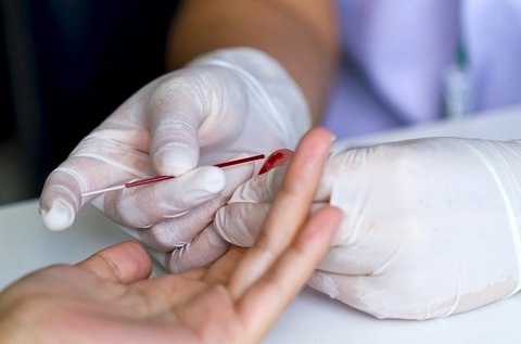 Vércseppanalízis Candida- és ételintolerancia teszttel