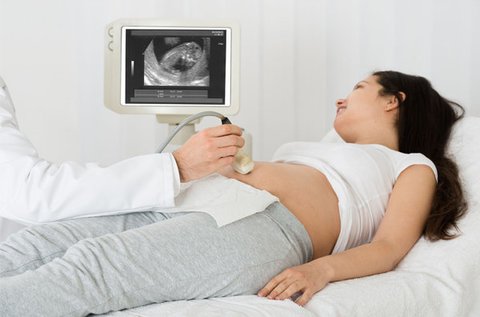 4D baba ultrahang video- és képrögzítéssel