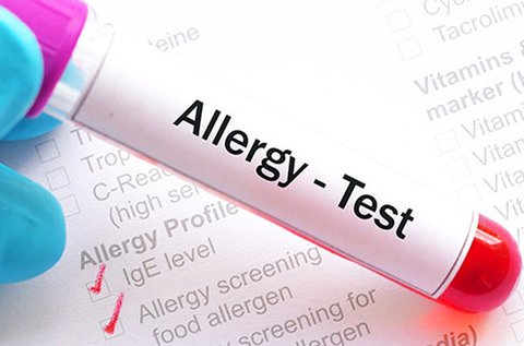 Átfogó, 104 pontos allergia vizsgálat