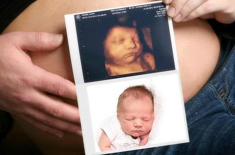 4D-s baba ultrahang vizsgálat