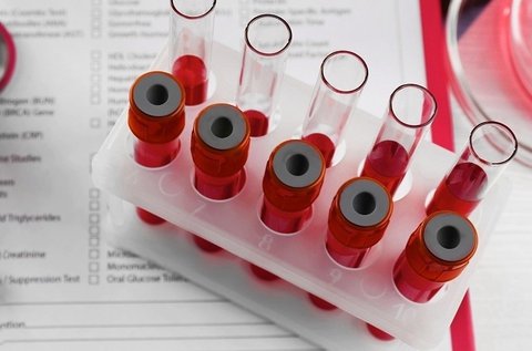 Vércseppanalízis Candida és ételintolerancia teszttel