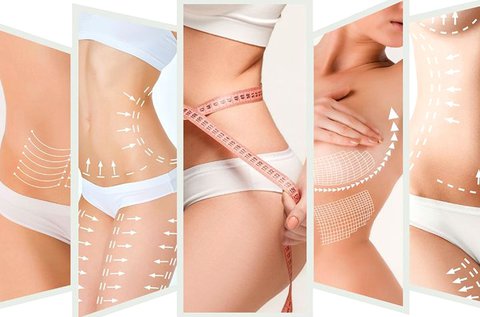 3 alkalmas zsírbontó kezelés csomag