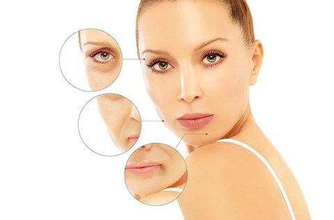 Soft Botox ampullás arcfiatalító kezelés