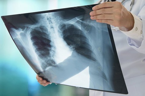 Kétoldali röntgen készítése választható testtájról