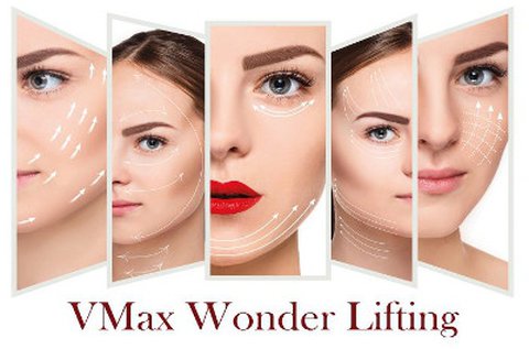 VMax Wonder Lifting 2 az 1-ben HIFU kezelés