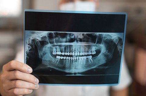 Teljes digitális fogászati panorámaröntgen