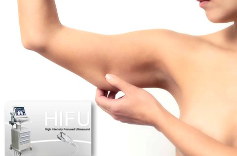 BodyArt HIFU felkar fogyasztás és feszesítés