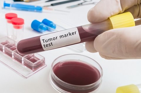 Tumormarker szűrés teljes vérképpel