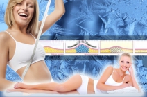 3 alkalmas Cryolipolysis zsírfagyasztás a belvárosban