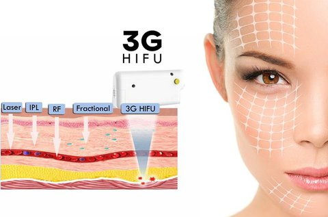 3G HIFU feszesítés arcon, nyakon és dekoltázson